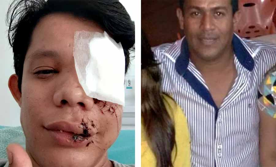 Empresário é Condenado a Pagar R$ 50 Mil a Professor Após Agressão Que Resultou em Perda de Olho Imagem do artigo