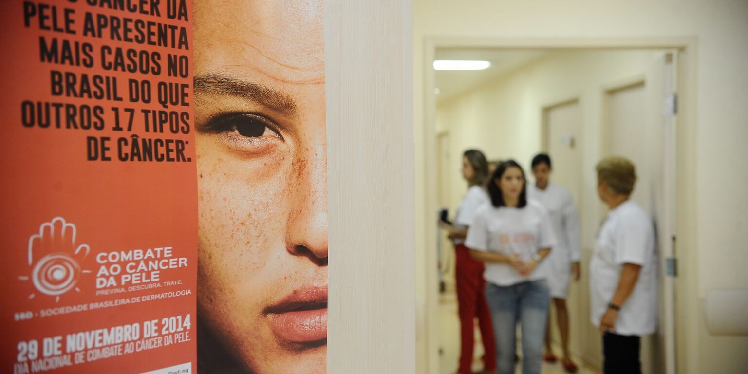 Câncer de Pele no Brasil: Aumento de Casos Salta para Mais de 72 Mil em 10 Anos
