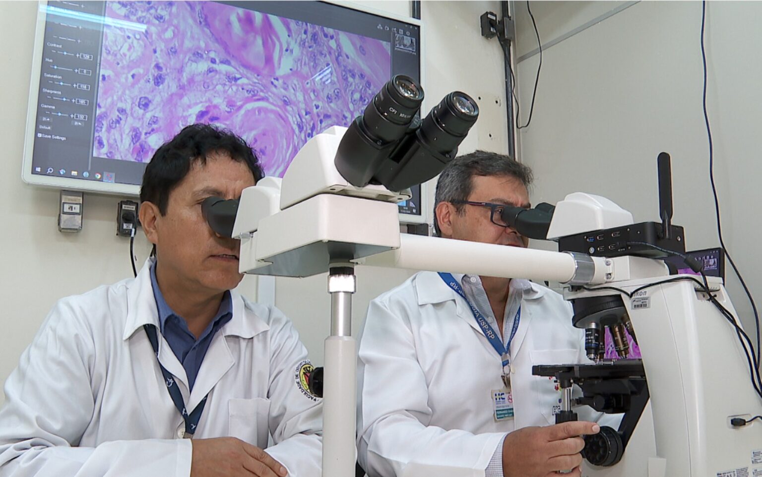 USP Revela Dados Cruciais sobre Câncer de Cabeça e Pescoço, Abrindo Caminhos para Novos Tratamentos