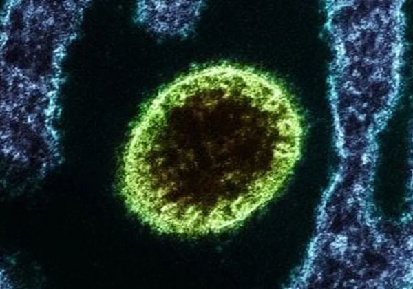 Ministério da Saúde Alerta: Novo Vírus Nipah e Risco de Contaminação no Brasil Ministério da Saúde Alerta: Novo Vírus Nipah e Risco de Contaminação no Brasil
