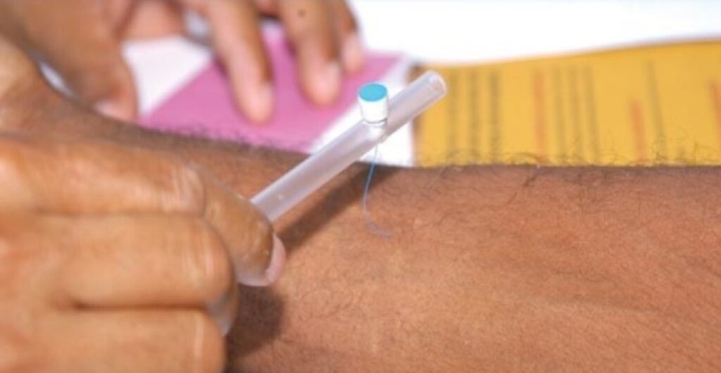 TCE-MT Recomenda Ampliação no Acesso à Talidomida para Tratamento da Hanseníase na Baixada Cuiabana TCE-MT Recomenda Ampliação no Acesso à Talidomida para Tratamento da Hanseníase na Baixada Cuiabana