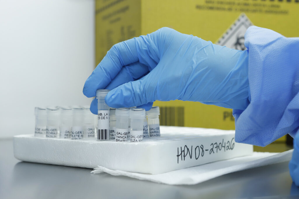 DF Inova com Teste de DNA-HPV para Rastreio do Câncer de Colo do Útero DF Inova com Teste de DNA-HPV para Rastreio do Câncer de Colo do Útero
