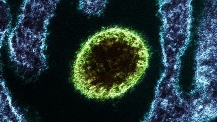 Alerta do Ministério da Saúde sobre o Vírus Nipah no Brasil: Entenda o Risco Alerta do Ministério da Saúde sobre o Vírus Nipah no Brasil: Entenda o Risco