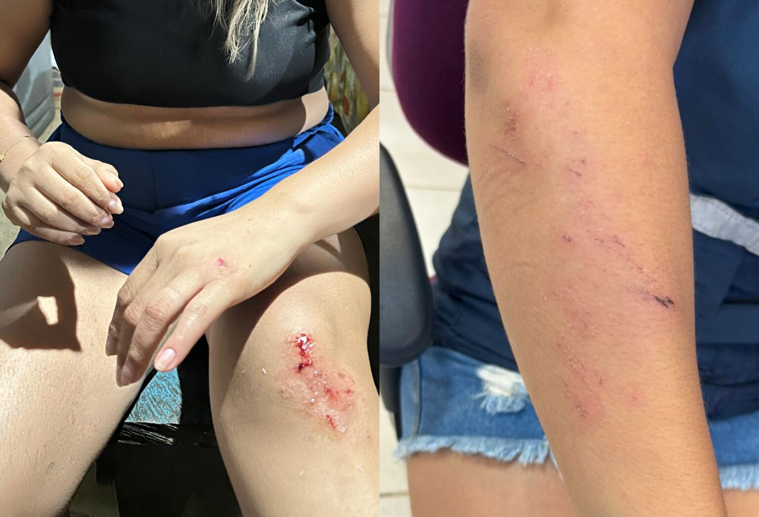 Violência em Polo de Saúde Yanomami: Ministério Retira Equipe Após Ataque Violência em Polo de Saúde Yanomami: Ministério Retira Equipe Após Ataque